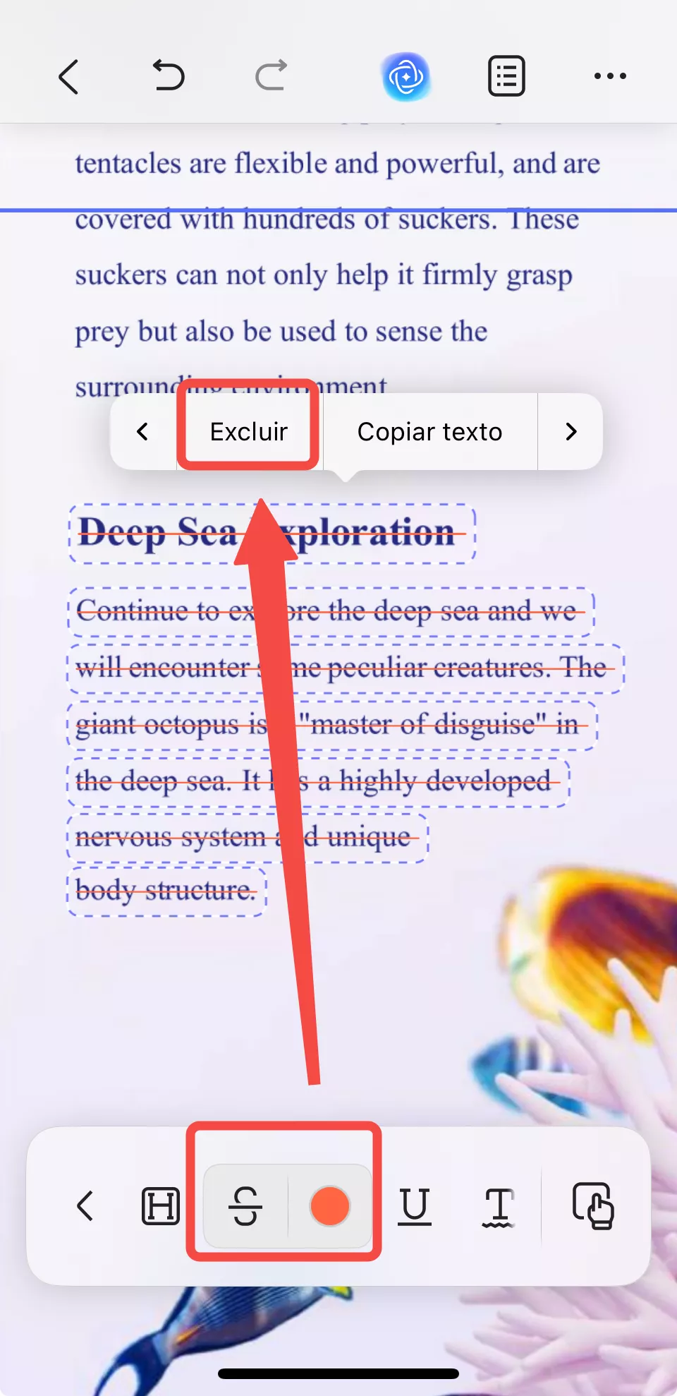 alterar as anotações