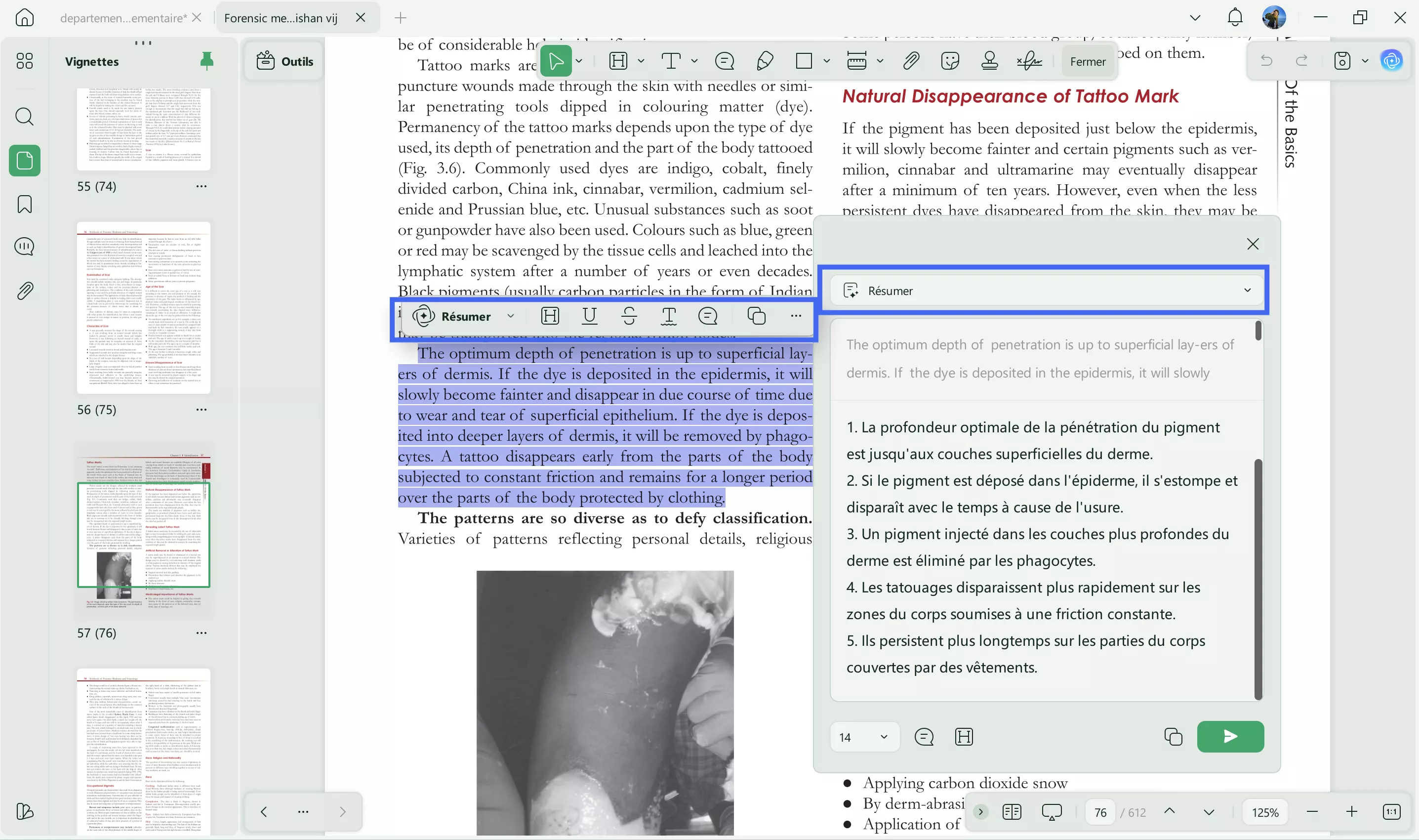 comment l'IA est-elle utilisée dans les soins de santé updf ai read