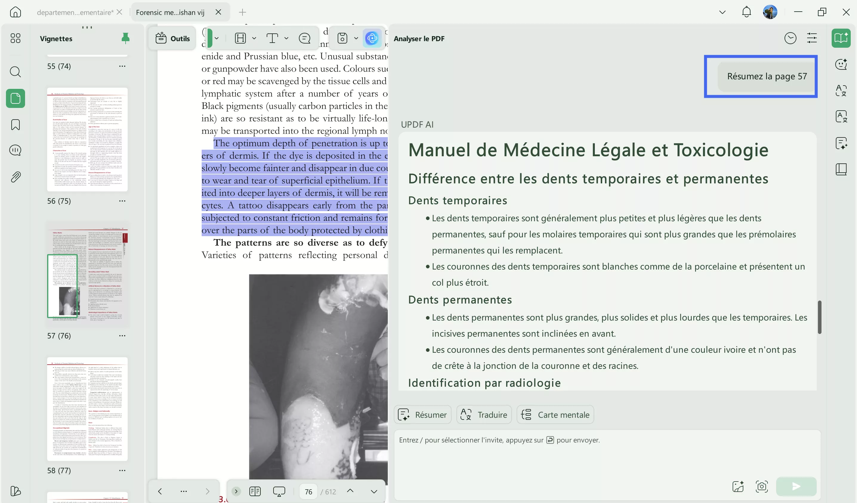 comment l'IA est-elle utilisée dans les soins de santé updf ai read