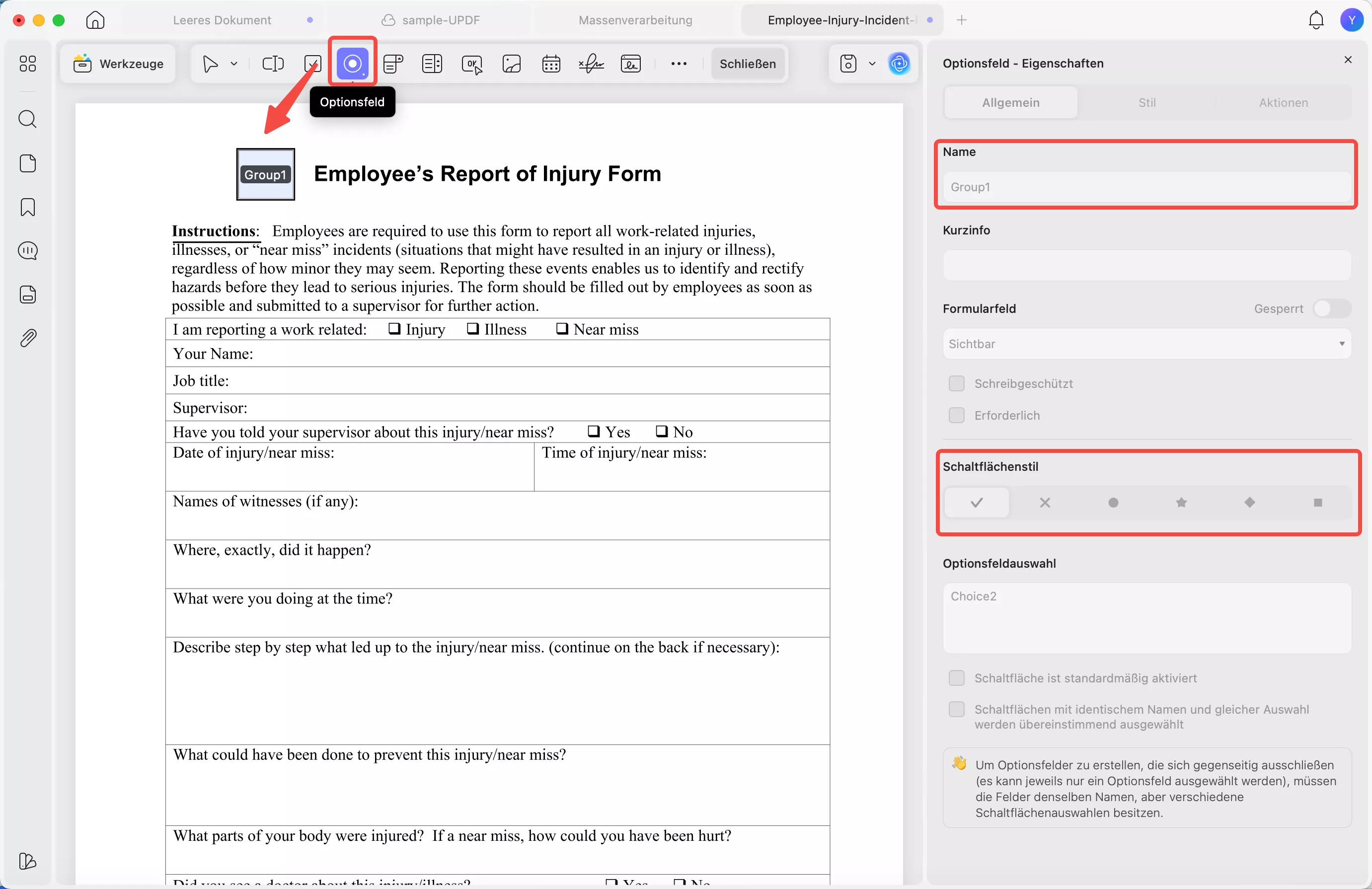 Optionsfeld hinzufügen