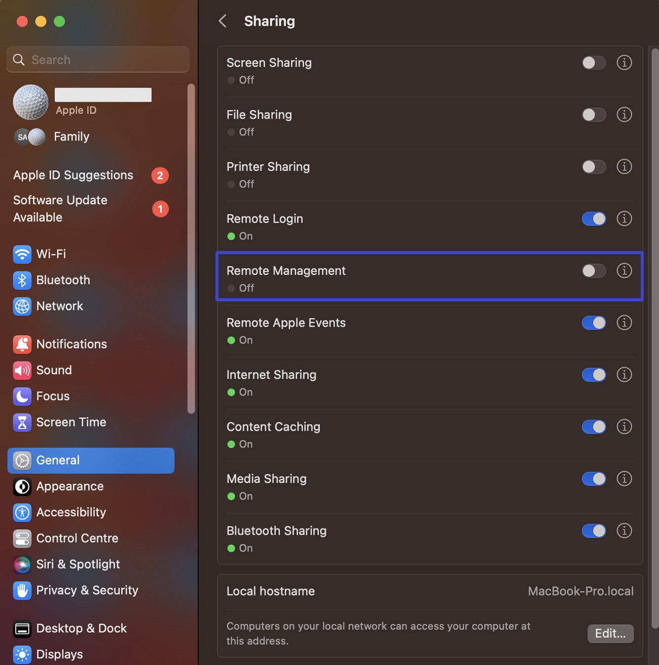 disable remote management toggle