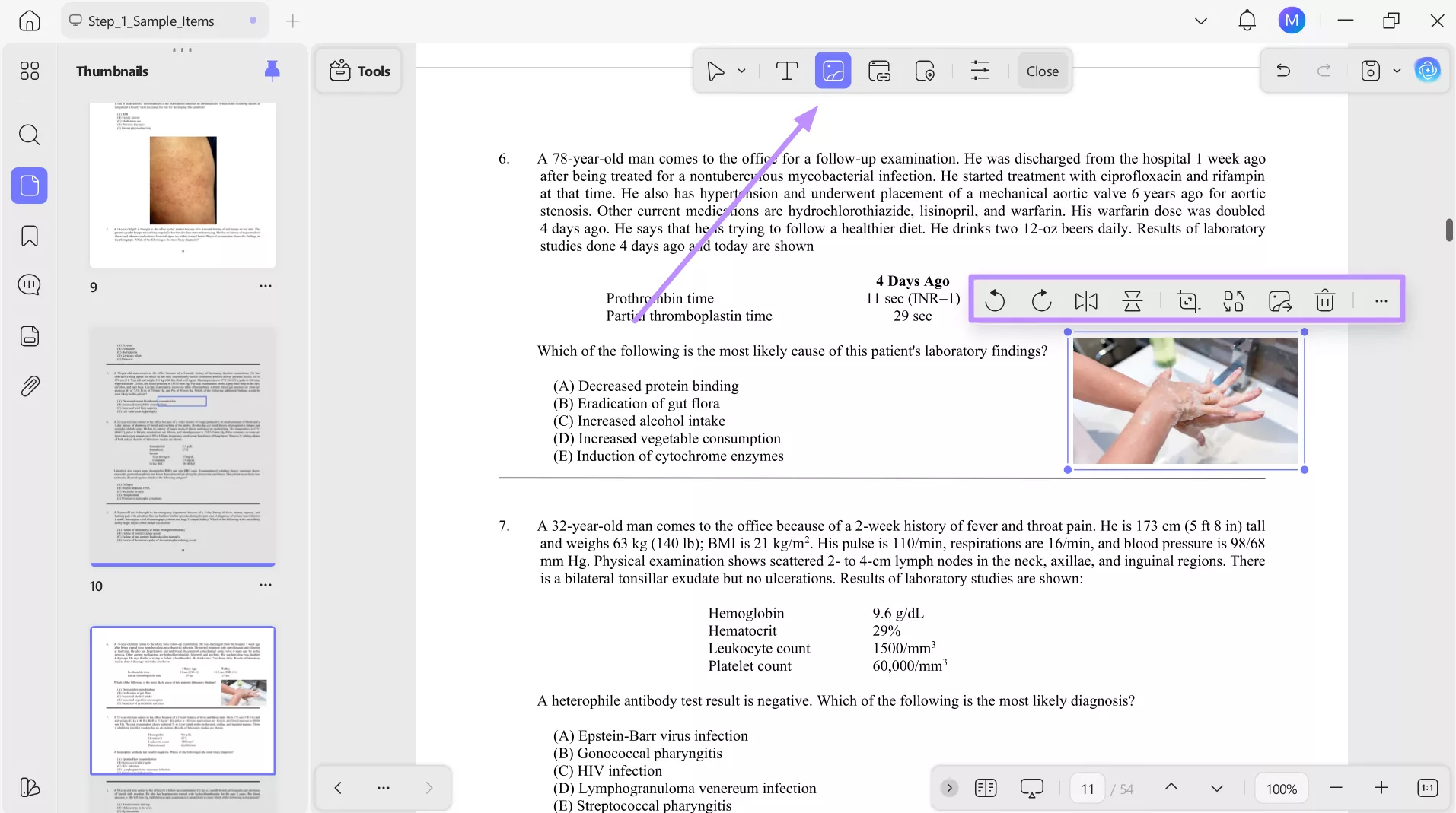 add image to usmle notes